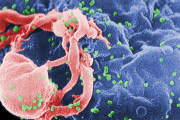 【海外】HIV克服の歴史的瞬間！世界で2人目の回復者誕生！