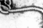 【中国の反応】日本の「エボラ」輸入に中国炎上「生物兵器の開発？！」「怖い！」
