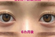 【画像あり】韓国人「日本の整形技術に韓国人もビックリ！」整形大国韓国人も『高くても整形は日本でしたい』と言う理由がこちらです‥ﾌﾞﾙﾌﾞﾙ　韓国の反応