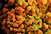 【海外】「世界初！女性のHIVが実質的に完治、治療の新たな希望」