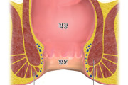ベトナム男性の肛門異物事故を韓国が報道、読者からは「危険行為を甘く見るな」と嫌悪と警告の声