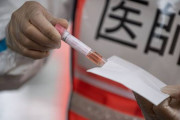 【韓国の反応】日本の厚生省、韓国製の診断キットは信頼性に疑問