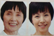 韓国人「日本のあまりにも率直な化粧品広告がこちらｗｗｗ」