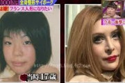 韓国人「日本の整形の特徴がマジでヤバ過ぎた‥」日本人が韓国に大勢来て整形をする理由がコチラ‥　韓国の反応