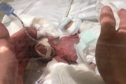 海外「素晴らしいよ・・・よくこの世に誕生した・・・」最小で生まれた日本の子供が海外で感動！