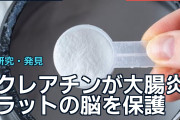 クレアチンが大腸炎ラットの脳を保護、海外で投与量と人への応用に議論