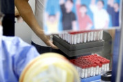 【悲報】韓国人「9月には1日140人死亡」韓国が人口比感染者が世界最多になってしまう‥　韓国の反応