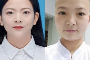 韓国人「現在の中国の女性医療関係者の状況を見てみよう」「小林サッカーを思い出すね」