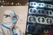 日本の製薬会社が新型コロナウイルス治療薬の開発を開始　海外の反応