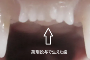 海外「今すぐ必要だ！」日本が実用化を進める薬に海外大興奮！（海外の反応）