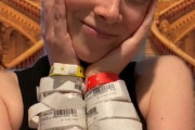 入院時のリストバンドを大量に付けたアメリカ人女性のブレスレットコレクション、総額1億7500万円（医療費）