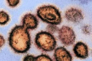 コロナウイルス殺菌効果が4時間持続する「奇跡の消毒剤」…日本の研究チームが発見＝韓国の反応