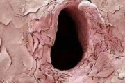 海外「俺には丁度いいサイズw」注射針が刺さった後の肌を顕微鏡で見てみた結果→アレにしか見えないと話題にw