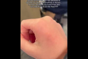 【海外の反応】韓国人男性がゴミの捨て方を間違ったシンガポール観光客の手にゴミ箱の蓋を叩きつける　海外の反応「韓国ドラマやアイドルで誤解している、外国人は歓迎されていない」