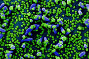【海外】アメリカで猛威を振るう「ストラタス」COVID-19サブバリアントの症状とは？あなたの健康を守る情報を解説！