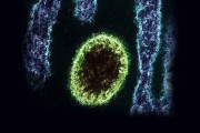 中国で35人が新種のウイルスに感染！もういい加減にしてくれ！！