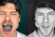 数年顎を鍛え続けるとどうなるのか？エラが超発達した男性モデルのビフォア・アフター（イタリア）