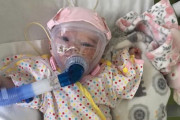 【強い】心臓と肺に持病がある生後6ヶ月の赤ちゃん、新型コロナを克服