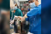 【閲覧注意】タバコを30年間吸い続けた男性の肺を摘出→ ヤバすぎるほど黒くなった物体が出てくる・・
