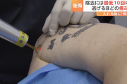 韓国人の反応「タトゥー除去がブーム！？後悔する人たちの声が続出」