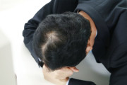韓国人「脱毛症治療薬に健康保険適用拡大！」→「重病患者が先だ！」