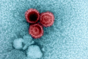 【海外】ループスは「私たちの95％が持っているウイルス」と関係がある？その理由がついに明らかに！