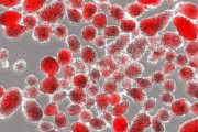 【韓国の反応】糖尿病、完治の道は開かれるのか？…日本の研究陣、膵臓細胞増殖動物実験に成功。韓国の反応「日本の基礎科学水準は確かに世界一流。」