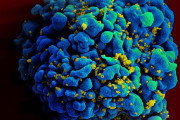 【海外】HIVを克服した第6の患者登場！最新の治療法が明らかに！