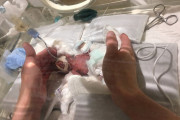 海外「おめでとう奇跡の赤ちゃん」268gで産まれた日本の超低出生体重児が無事退院