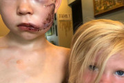 海外「本物の英雄だ！」襲いかかる犬の前に立ちはだかり、妹の命を救った幼い少年が海外で話題に　