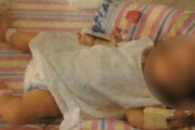 ヴィーガン「幼児にも食事制限させていたら栄養失調で骨折してもうた！」→海外「児童虐待かな」