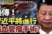 【韓国の反応】「習近平、脳動脈瘤異常て入院」 反中YouTubeメディア・Twitterで拡散
