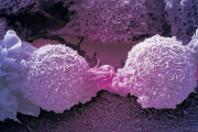 海外「イギリスの科学者がほぼ全ての癌細胞を殺せる免疫細胞を偶然発見する」