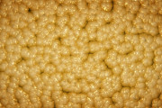 【海外】脂肪細胞が自ら燃える！？画期的なダイエット法の可能性とは