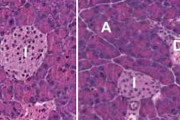 【海外】「がんと闘う新しいインプラント！免疫を活性化して腫瘍を安全に撃退する革新技術」