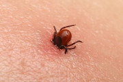 【海外】人間の体に住み着く10種類の虫たちの驚くべき生態とは？