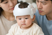 赤ちゃんの頭の形矯正ヘルメットが急拡大…韓国コメント欄は「美容目的は危険」vs「医療必要な家庭まで叩くな」で激論
