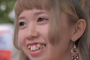 中国人「こういう日本人の歯並びってカワイイと思う？」　中国の反応
