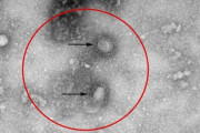 【韓国の反応】日本 新種のコロナウィルス分離成功 ... 薬の開発に活用【新型肺炎】