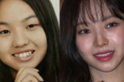 外国人「なんでアジア人女性はこんな整形手術をするんだ？」