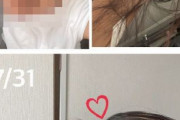 【韓国の反応】日本の20代女性、モデルナ打ってハゲ頭になった…韓国の反応「コロナにかかって治療を受けたほうが安全。ワクチンは選択であって義務ではない。」